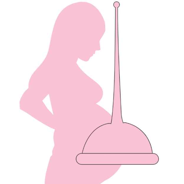 Pregnant lady with conception cup