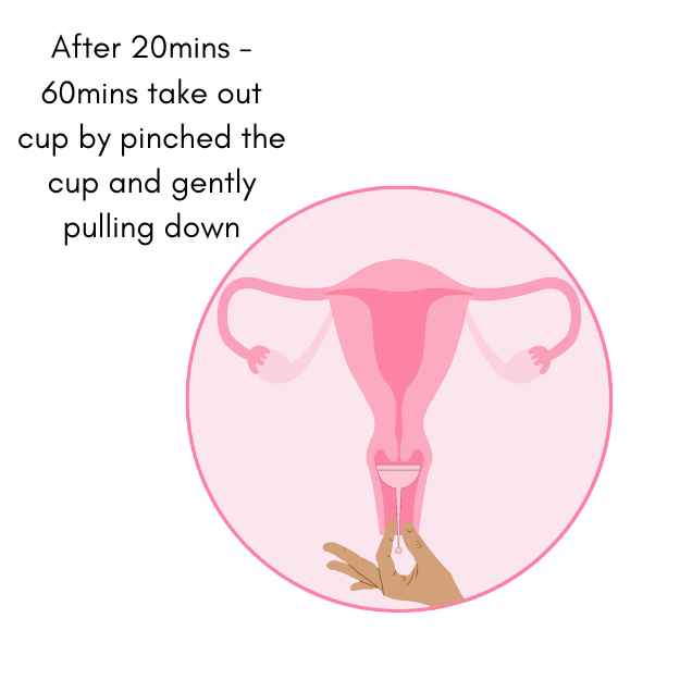 getting pregnant using cup or conception cup after using after intercourse leave in for 20 to 60 mins and to take out and pinch out and pull down