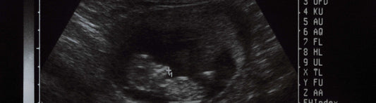 9 Weeks Pregnant Symptoms: What to Expect in Early Pregnancy